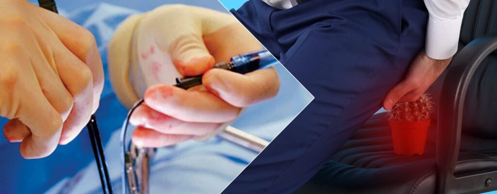 Experienced doctors for piles laser in Tehran