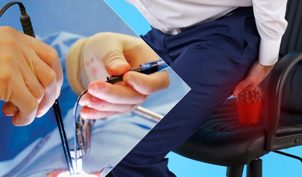 Experienced doctors for piles laser in Tehran